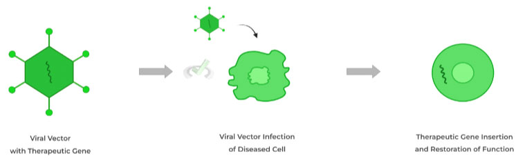 Viral Vector Gene Therapy