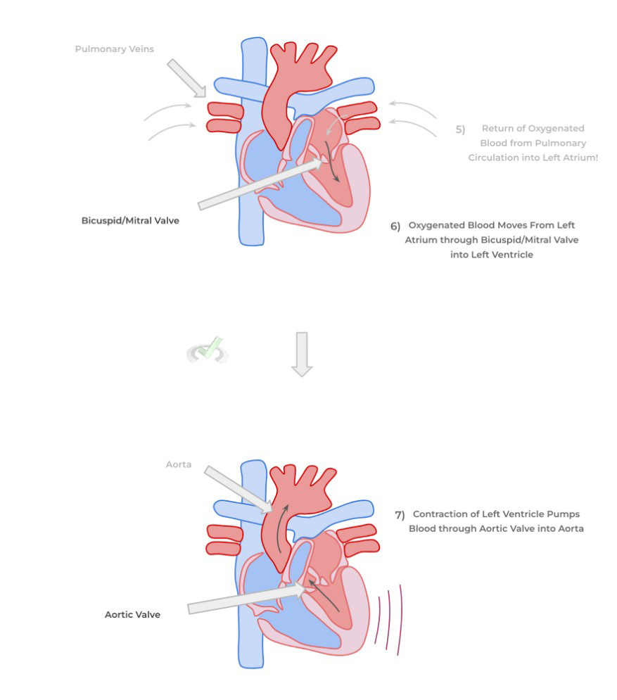 Bicuspid Valve