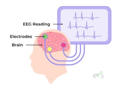 Electroencephalography (Eeg)