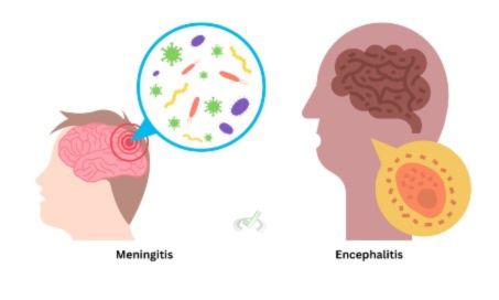 Infectious Disorders