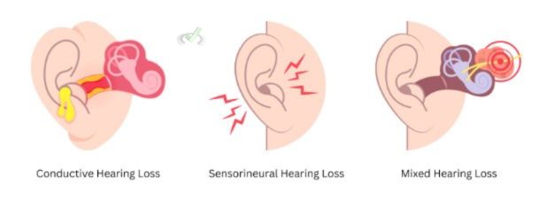 Issues In Auditory Signal Transduction