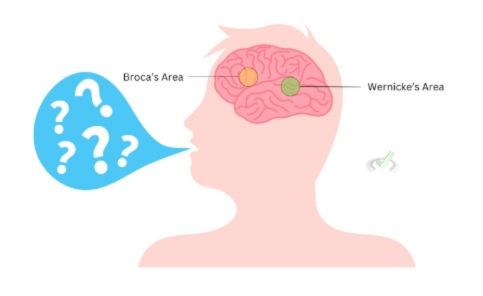 Language And Brain Structure