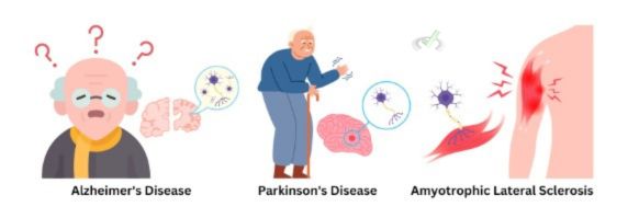 Neurodegenerative Disorders