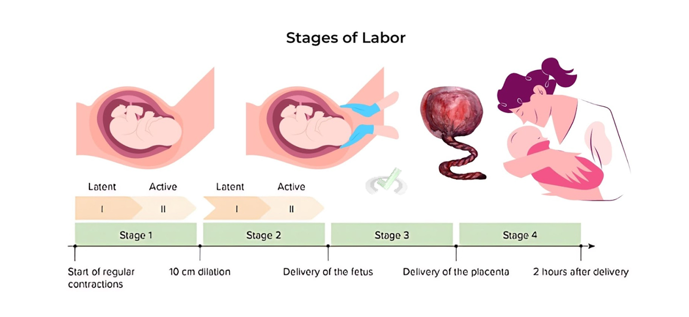 Stages Of Labor