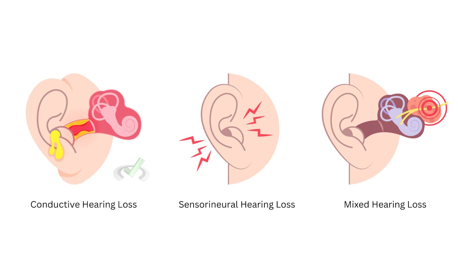Hearing Problems